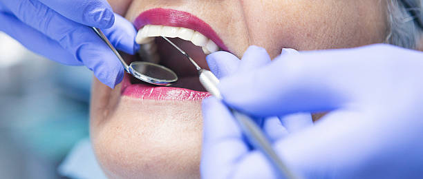 Emergency Treatment for Gum Disease